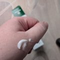 Спасаем кожу после родов